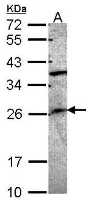 Western Blot: GRAP Antibody [NBP1-33626] - Sample (30 ug of whole cell lysate) A: A549 12% SDS PAGE; antibody diluted at 1:1000.