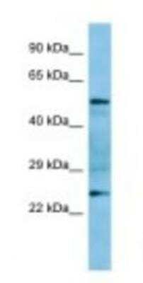 Western Blot: GRAP Antibody [NBP1-98421] - Rat Spleen Lysate 1.0ug/ml