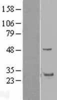 Western Blot: GRAP Overexpression Lysate (Adult Normal) [NBL1-11323] Left-Empty vector transfected control cell lysate (HEK293 cell lysate); Right -Over-expression Lysate for GRAP.