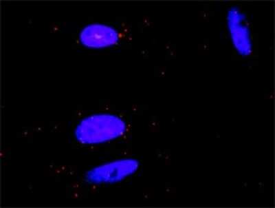 Proximity Ligation Assay: GRAP2 Antibody [H00009402-D01P] - Analysis of protein-protein interactions between GRAP2 and CSF1R. HeLa cells were stained with anti-GRAP2 rabbit purified polyclonal 1:1200 and anti-CSF1R mouse monoclonal antibody 1:50. Each red dot represents the detection of protein-protein interaction complex, and nuclei were counterstained with DAPI (blue).