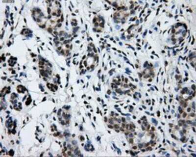 Immunohistochemistry-Paraffin: GRASP1 Antibody (1E3) [NBP2-02277] - Staining of paraffin-embedded breast tissue using anti-GRASP1 mouse monoclonal antibody.