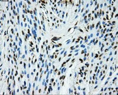 Immunohistochemistry-Paraffin: GRASP1 Antibody (1E3) [NBP2-02277] - Staining of paraffin-embedded endometrium tissue using anti-GRASP1 mouse monoclonal antibody.