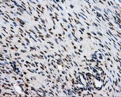 Immunohistochemistry-Paraffin: GRASP1 Antibody (1E3) [NBP2-02277] - Staining of paraffin-embedded Ovary tissue using anti-GRASP1 mouse monoclonal antibody.