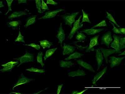 Immunocytochemistry/Immunofluorescence: GRASP1 Antibody [H00056850-B01P] - Analysis of purified antibody to GRIPAP1 on HeLa cell. (antibody concentration 20 ug/ml)