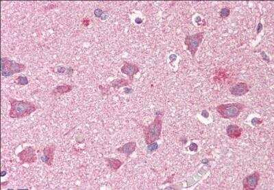 Immunohistochemistry-Paraffin: GRASP1 Antibody [NB100-1432] - staining of paraffin embedded Human Cortex. Steamed antigen retrieval with citrate buffer pH 6, AP-staining.