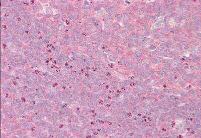 Immunohistochemistry-Paraffin GRASP1 Antibody