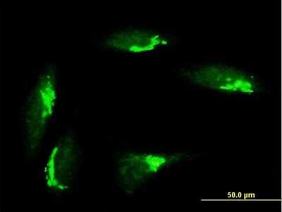 Immunocytochemistry/Immunofluorescence: GRASP65 Antibody [H00064689-B01P] - Analysis of purified antibody to GORASP1 on HeLa cell. (antibody concentration 10 ug/ml)