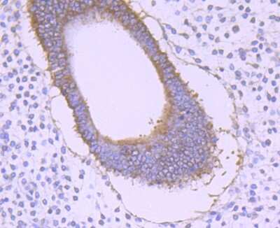 Immunohistochemistry-Paraffin: GRASP65 Antibody (JB36-34) [NBP2-75516] - Analysis of paraffin-embedded human uterine tissue using anti-GRASP65 antibody. Counter stained with hematoxylin.
