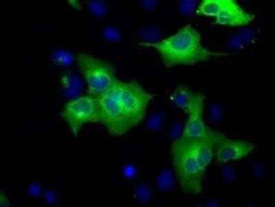 Immunocytochemistry/Immunofluorescence: GRASP65 Antibody (OTI5G8) - Azide and BSA Free [NBP2-72144] - Staining of COS7 cells transiently transfected by pCMV6-ENTRY GRASP65.