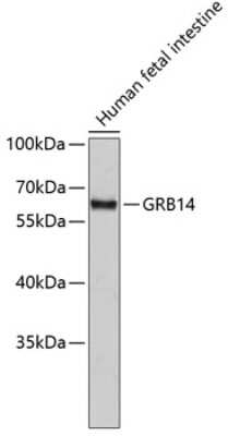 Western Blot: GRB 14 Antibody [NBP2-94010] - Analysis of extracts of human fetal intestine, using GRB 14 at 1:10000 dilution.Lysates/proteins: 25ug per lane.Blocking buffer: 3% nonfat dry milk in TBST.