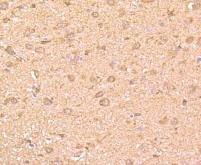 Immunohistochemistry-Paraffin: GRB2 Antibody (11-B11) [NBP2-80405] - Analysis of rat brain tissue using GRB2 antibody. Counter stained with hematoxylin.