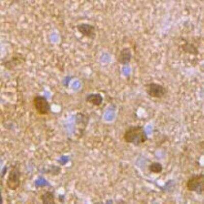 Immunohistochemistry-Paraffin: GRB2 Antibody (11-B11) [NBP2-80405] - Analysis of mouse brain tissue using GRB2 antibody. Primary antibody dilution 1:100. Image from verified customer review.