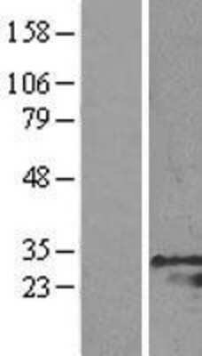 Western Blot: GRB2 Overexpression Lysate (Adult Normal) [NBL1-11326] Left-Empty vector transfected control cell lysate (HEK293 cell lysate); Right -Over-expression Lysate for GRB2.