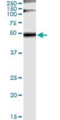 Immunoprecipitation: GRB7 Antibody (3C12) [H00002886-M03] - Analysis of GRB7 transfected lysate using anti-GRB7 monoclonal antibody and Protein A Magnetic Bead, and immunoblotted with GRB7 rabbit polyclonal antibody.