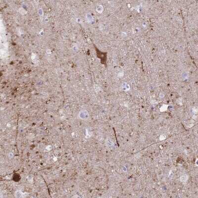 Immunohistochemistry: GRB7 Antibody [NBP2-49243] - Staining of human cerebral cortex shows strong cytoplasmic positivity in neuronal cells.