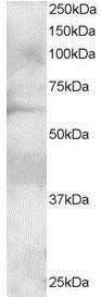 Western Blot: GRB7 Antibody [NB100-1027] - Antibody at 1ug/ml. Staining of A431 lysate (35u g protein in RIPA buffer). Detected by chemiluminescence.