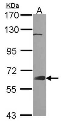 Western Blot: GRB7 Antibody [NBP1-30964] - Sample (30 ug of whole cell lysate) A: A431 7. 5% SDS PAGE GRB7 antibody, antibody diluted at 1:1000.