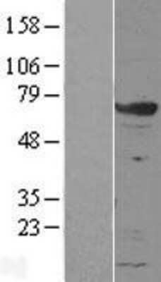 Western Blot: GRB7 Overexpression Lysate (Adult Normal) [NBL1-11327] Left-Empty vector transfected control cell lysate (HEK293 cell lysate); Right -Over-expression Lysate for GRB7.