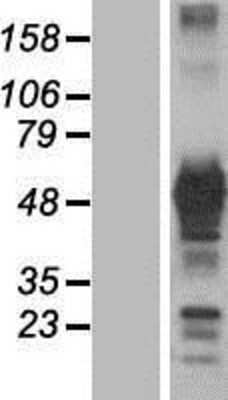 Western Blot: GRB7 Overexpression Lysate (Adult Normal) [NBP2-08604] Left-Empty vector transfected control cell lysate (HEK293 cell lysate); Right -Over-expression Lysate for GRB7.