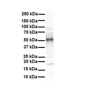 Western Blot: GREB1 Antibody [NBP3-10496] - Western blot analysis of GREB1 in Human heart. Antibody dilution at 1 ug/mL