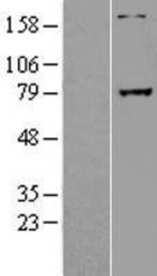 Western Blot: GREB1 Overexpression Lysate (Adult Normal) [NBL1-11329] Left-Empty vector transfected control cell lysate (HEK293 cell lysate); Right -Over-expression Lysate for GREB1.