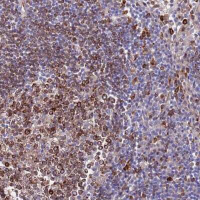 Immunohistochemistry-Paraffin: GREB1L Antibody [NBP2-33415] - Staining of human lymph node shows strong cytoplasmic positivity in germinal center cells.
