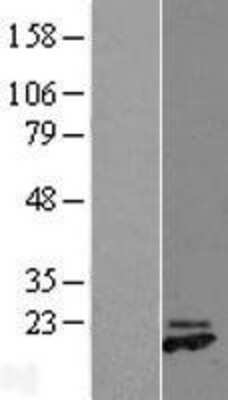 Western Blot: GREM2 Overexpression Lysate (Adult Normal) [NBL1-11330] Left-Empty vector transfected control cell lysate (HEK293 cell lysate); Right -Over-expression Lysate for GREM2.