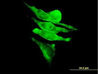 Immunocytochemistry/Immunofluorescence: GRF2 Antibody [H00002889-B01P] - Analysis of purified antibody to RAPGEF1 on HeLa cell. (antibody concentration 10 ug/ml)