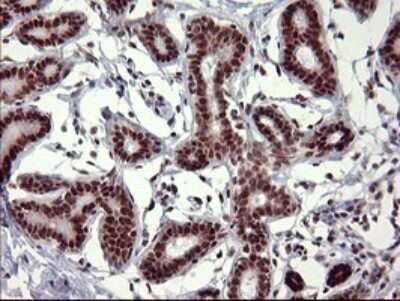 Immunohistochemistry: GRF2 Antibody (OTI2F5) - Azide and BSA Free [NBP2-70846] - Analysis of Human breast tissue. (Heat-induced epitope retrieval by 10mM citric buffer, pH6.0, 120C for 3min)