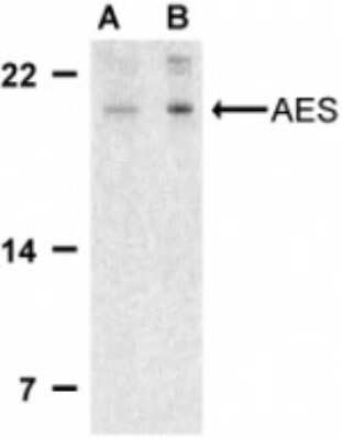 Western Blot: GRG (Groucho homolog) Antibody [NBP1-76646] - Analysis of GRG (Groucho homolog) in 293 cell lysate with GRG (Groucho homolog) antibody using NBP1-76646 at (A) 2 and (B) and 4 ug/ml.