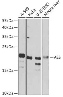 Western Blot: GRG (Groucho homolog) Antibody [NBP3-03405] - Analysis of extracts of various cell lines, using GRG (Groucho homolog) antibody at 1:1000 dilution. Secondary antibody: HRP Goat Anti-Rabbit IgG (H+L) at 1:10000 dilution. Lysates/proteins: 25ug per lane. Blocking buffer: 3% nonfat dry milk in TBST.