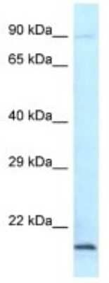 Western Blot: GRG (Groucho homolog) Antibody [NBP3-10455] - Western blot analysis of GRG (Groucho homolog) in Mouse Heart lysates. Antibody dilution at 1.0ug/ml