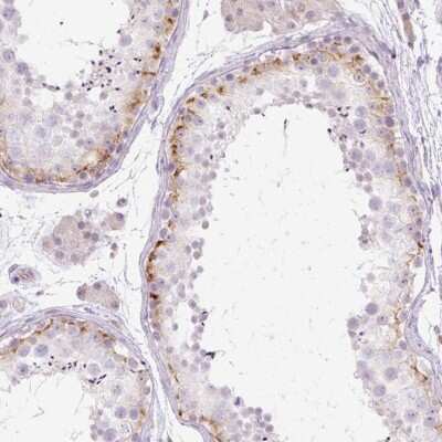 <b>Orthogonal Strategies Validation. </b>Immunohistochemistry-Paraffin: GRID2 Antibody [NBP2-31632] - Staining of human testis shows high expression.