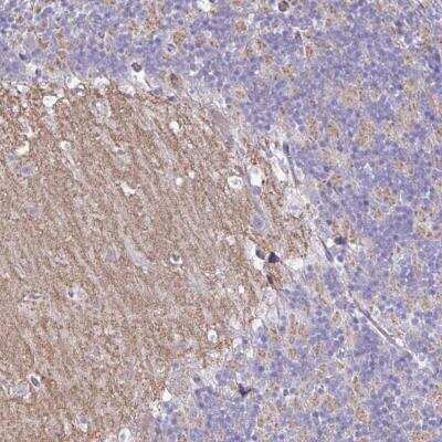 Immunohistochemistry-Paraffin: GRID2 Antibody [NBP2-31723] - Staining of human cerebellum shows distinct positivity in neuropil of the molecular layer.