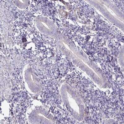Immunohistochemistry-Paraffin: GRID2 Antibody [NBP2-31723] - Staining of human endometrium shows low expression as expected.