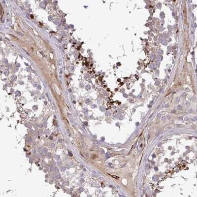 Immunohistochemistry-Paraffin GRID2 Antibody - BSA Free