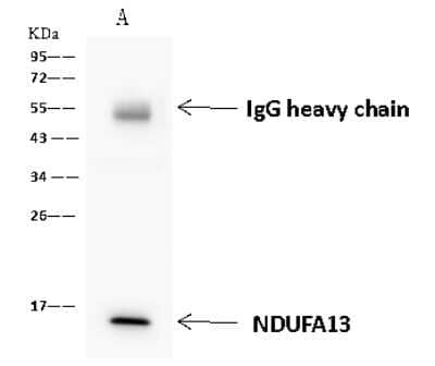 Immunoprecipitation: GRIM19 Antibody [NBP2-98488] - GRIM19 was immunoprecipitated using: Lane A: 0.5 mg K562 Whole Cell Lysate. 4 ul anti-GRIM19 rabbit polyclonal antibody and 60 ug of Immunomagnetic beads. Protein A/G. Primary antibody: Anti-GRIM19 rabbit polyclonal antibody, at 1:100 dilution. Secondary antibody: Goat Anti-Rabbit IgG (H+L)/HRP at 1/10000 dilution. Developed using the ECL technique. Performed under reducing conditions. Predicted band size: 17 kDa. Observed band size: 15 kDa