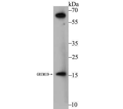 Western Blot: GRIM19 Antibody (JG82-33) [NBP2-75517] - Analysis of GRIM19 on MCF-7 cell using anti-GRIM19 antibody at 1/1,000 dilution.