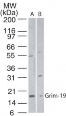 Western Blot: GRIM19 Antibody [NB100-56621] - Analysis of GRIM-19 in A) human heart and B) HeLa cell lysate using GRIM-19 antibody at 1:500. Goat anti-rabbit Ig HRP secondary antibody and PicoTect ECL substrate solution were used for this test.