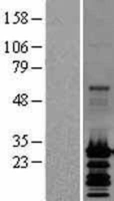 Western Blot: GRIM19 Overexpression Lysate (Adult Normal) [NBL1-13538] Left-Empty vector transfected control cell lysate (HEK293 cell lysate); Right -Over-expression Lysate for GRIM19.