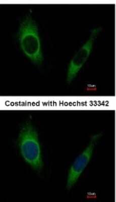 Immunocytochemistry/Immunofluorescence: GRK2 Antibody [NBP1-32534] - Analysis of methanol-fixed HeLa, using antibody at 1:500 dilution.