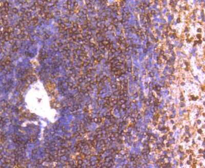 Immunohistochemistry-Paraffin: GRK2 Antibody (ST05-60) [NBP2-67542] - Analysis of paraffin-embedded human spleen tissue using anti-GRK2 antibody. Counter stained with hematoxylin.