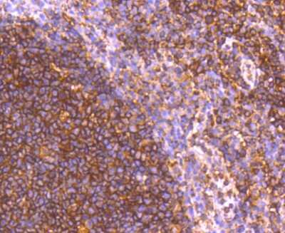 Immunohistochemistry-Paraffin: GRK2 Antibody (ST05-60) [NBP2-67542] - Analysis of paraffin-embedded human tonsil tissue using anti-GRK2 antibody. Counter stained with hematoxylin.