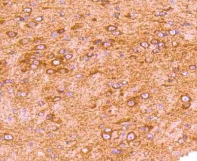 Immunohistochemistry-Paraffin: GRK2 Antibody (ST05-60) [NBP2-67542] - Analysis of paraffin-embedded mouse brain tissue using anti-GRK2 antibody. Counter stained with hematoxylin.