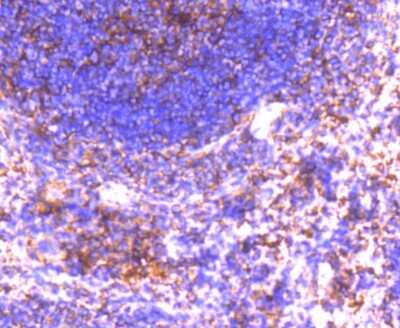 Immunohistochemistry-Paraffin: GRK2 Antibody (ST05-60) [NBP2-67542] - Analysis of paraffin-embedded mouse spleen tissue using anti-GRK2 antibody. Counter stained with hematoxylin.
