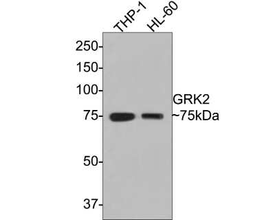 Western Blot: GRK2 Antibody (ST05-60) [NBP2-67542] - Analysis of GRK2 on different lysates with Rabbit anti-GRK2 antibody at 1/500 dilution. Lane 1: THP-1 cell lysate Lane 2: HL-60 cell lysate Lysates/proteins at 10 ug/Lane. Predicted band size: 80 kDa Observed band size: 75 kDa Exposure time: 1 minute; 8% SDS-PAGE gel. Proteins were transferred to a PVDF membrane and blocked with 5% NFDM/TBST for 1 hour at room temperature. The primary antibody at 1/500 dilution was used in 5% NFDM/TBST at room temperature for 2 hours. Goat Anti-Rabbit IgG - HRP Secondary Antibody at 1:300,000 dilution was used for 1 hour at room temperature.
