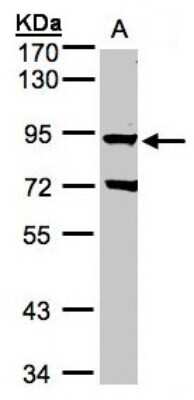 Western Blot: GRK2 Antibody [NBP1-32534] - Sample(30 ug whole cell lysate)A:Raji  7. 5% SDS PAGE, antibody diluted at 1:1000.