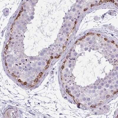 Immunohistochemistry-Paraffin: GRK4 Antibody [NBP2-37960] - Staining of human testis shows strong cytoplasmic positivity in a subset of cells in seminiferous ducts.