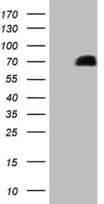 Western Blot: GRK4 Antibody (OTI4F5) - Azide and BSA Free [NBP2-70845] - Analysis of HEK293T cells were transfected with the pCMV6-ENTRY control (Left lane) or pCMV6-ENTRY GRK4.
