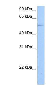 Western Blot: GRK4 Antibody [NBP1-55313] - Jurkat cell lysate, concentration 0.2-1 ug/ml.